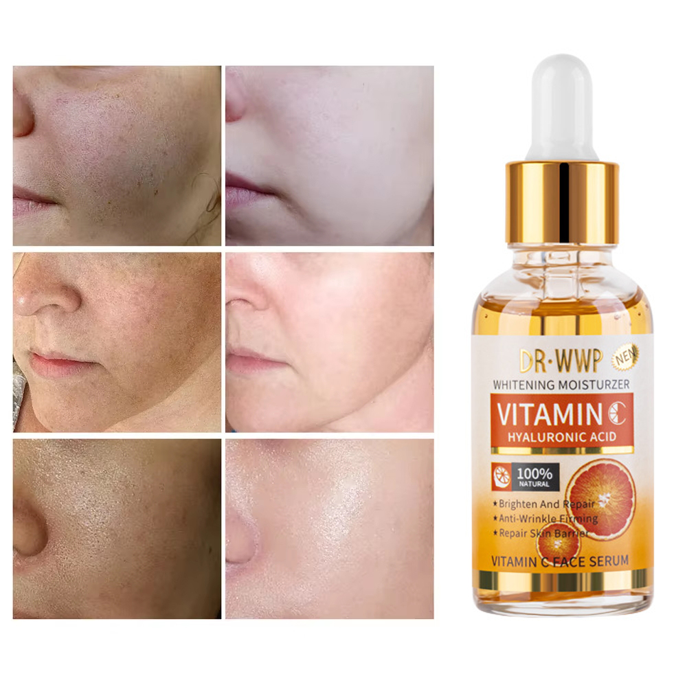 Skincare Garnier - Disaar-soro de vitamina c para rosto,