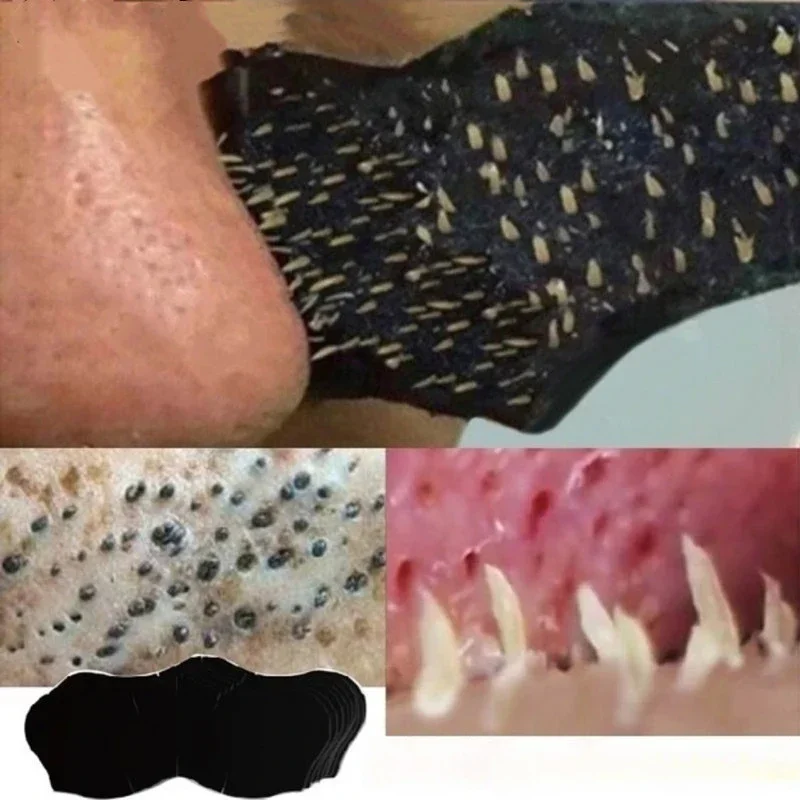 Unissex cravo remover máscara  - Charcoal Pore Strip avaliação e preço