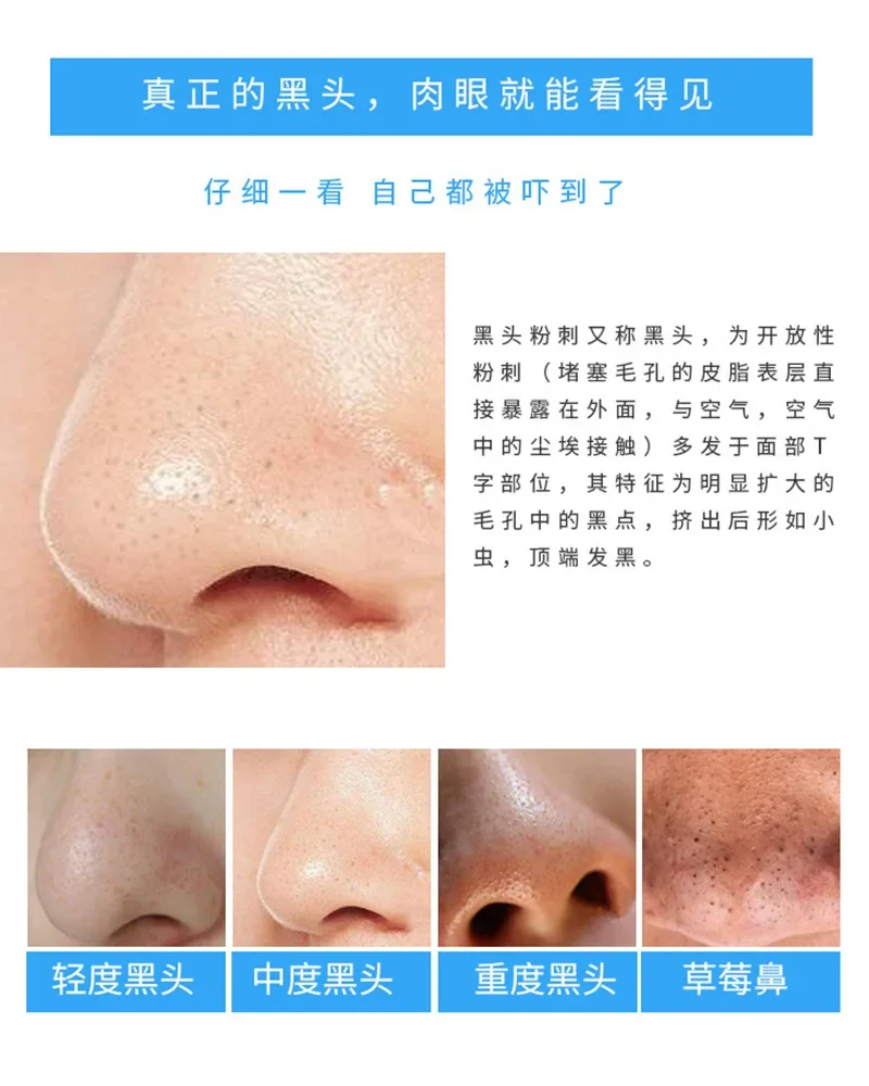 30 tiras de nariz de carvão de - Charcoal Pore Strip avaliação e preço
