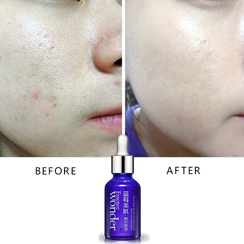 Bioaqua blueberry lifting faci - Skincare Garnier avaliação e preço