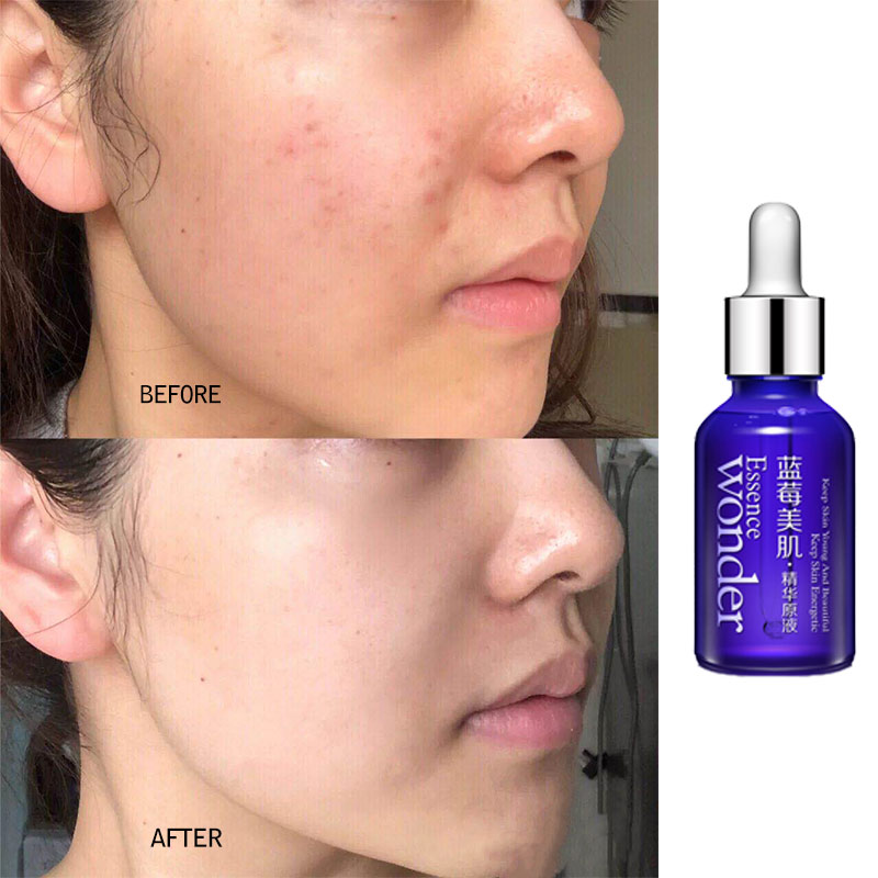 Bioaqua blueberry lifting faci - Skincare Garnier avaliação e preço
