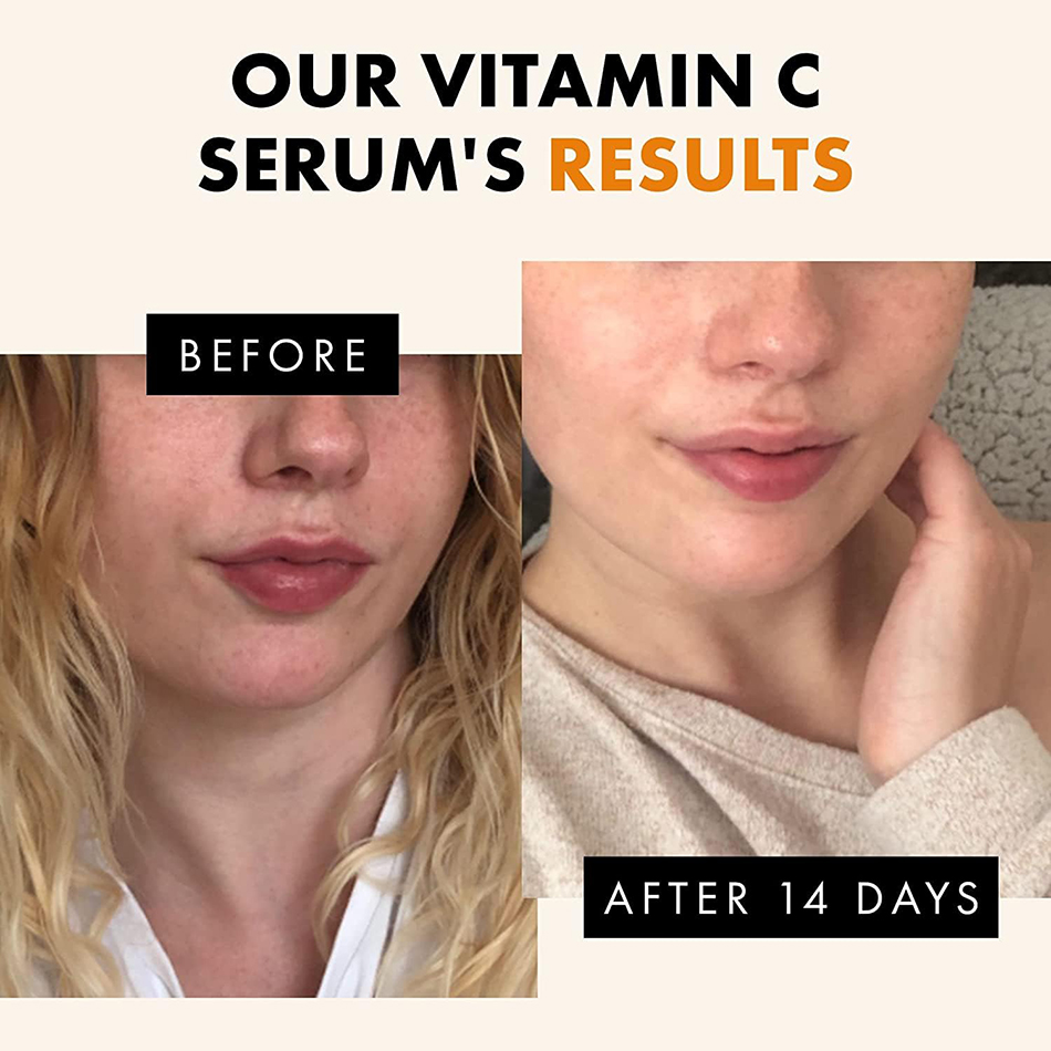 120ml 99% vitamina c soro óleo - Skincare Garnier avaliação e preço