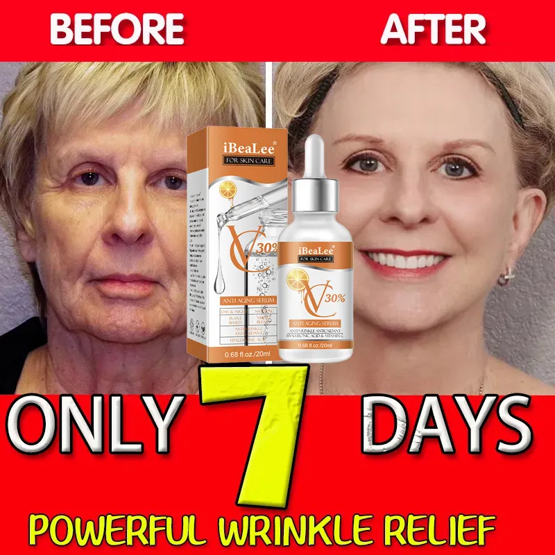 Ácido hialurônico Retinol Soro - Skincare Garnier avaliação e preço