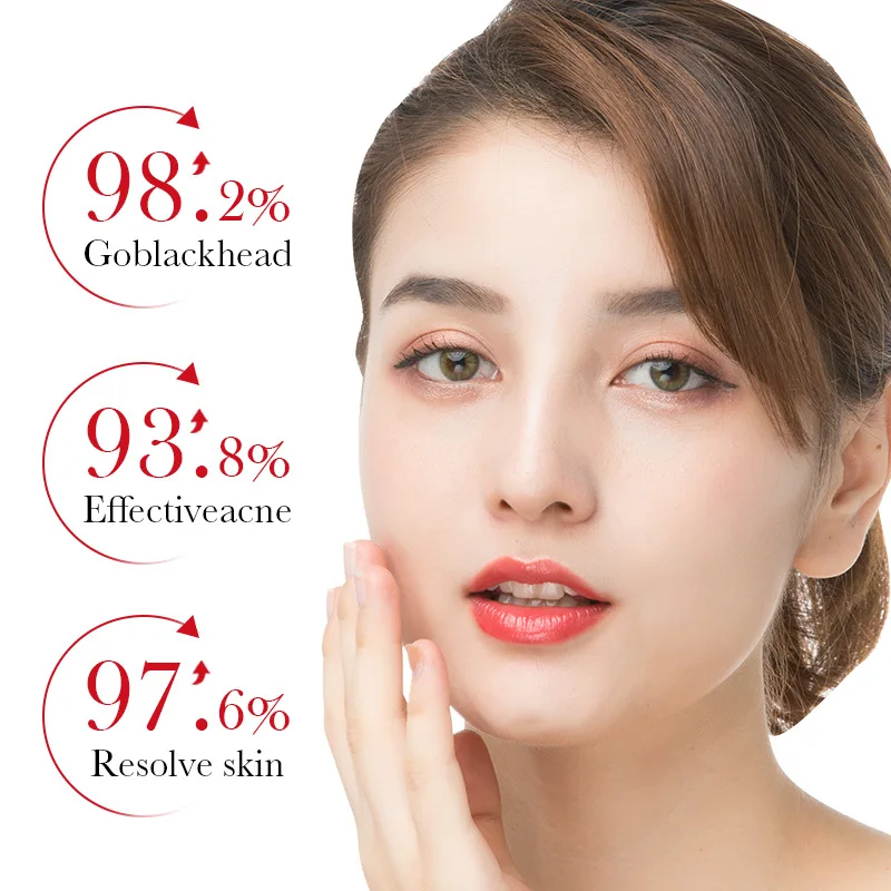 Bioaqua ácido salicílico acne  - Skincare Garnier avaliação e preço